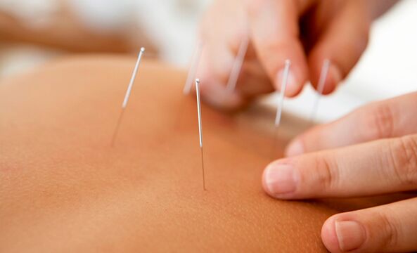 gücü artırmak için akupunktur